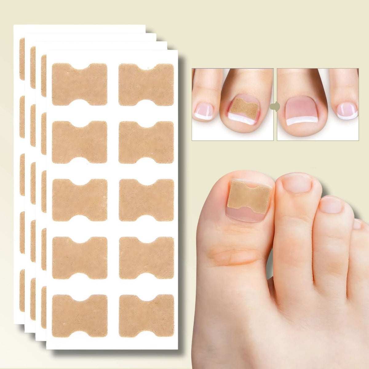 CURVENA - Ingrown Nail Correction Strips for Gentle Pressure Relief