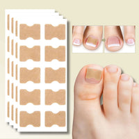 CURVENA - Ingrown Nail Correction Strips for Gentle Pressure Relief