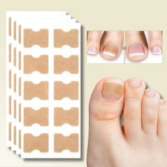 CURVENA - Ingrown Nail Correction Strips for Gentle Pressure Relief