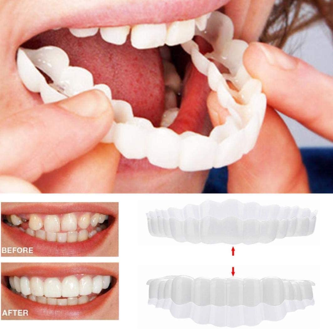 SMIVORA - Removable Dental Veneers for a More Even-Looking Smile