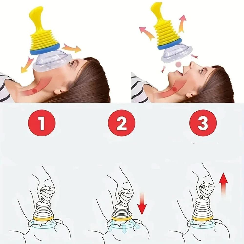 AEROVEXA - Airway Suction Device for Choking Emergency Assistance