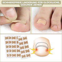 CURVENA - Ingrown Nail Correction Strips for Gentle Pressure Relief
