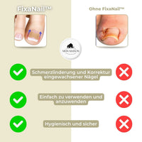CURVENA - Ingrown Nail Correction Strips for Gentle Pressure Relief