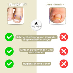 CURVENA - Ingrown Nail Correction Strips for Gentle Pressure Relief