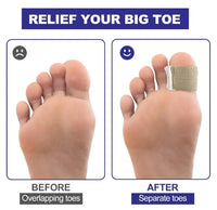 DIGELYA - Gel Toe Spacers for Comfortable Bunion Alignment