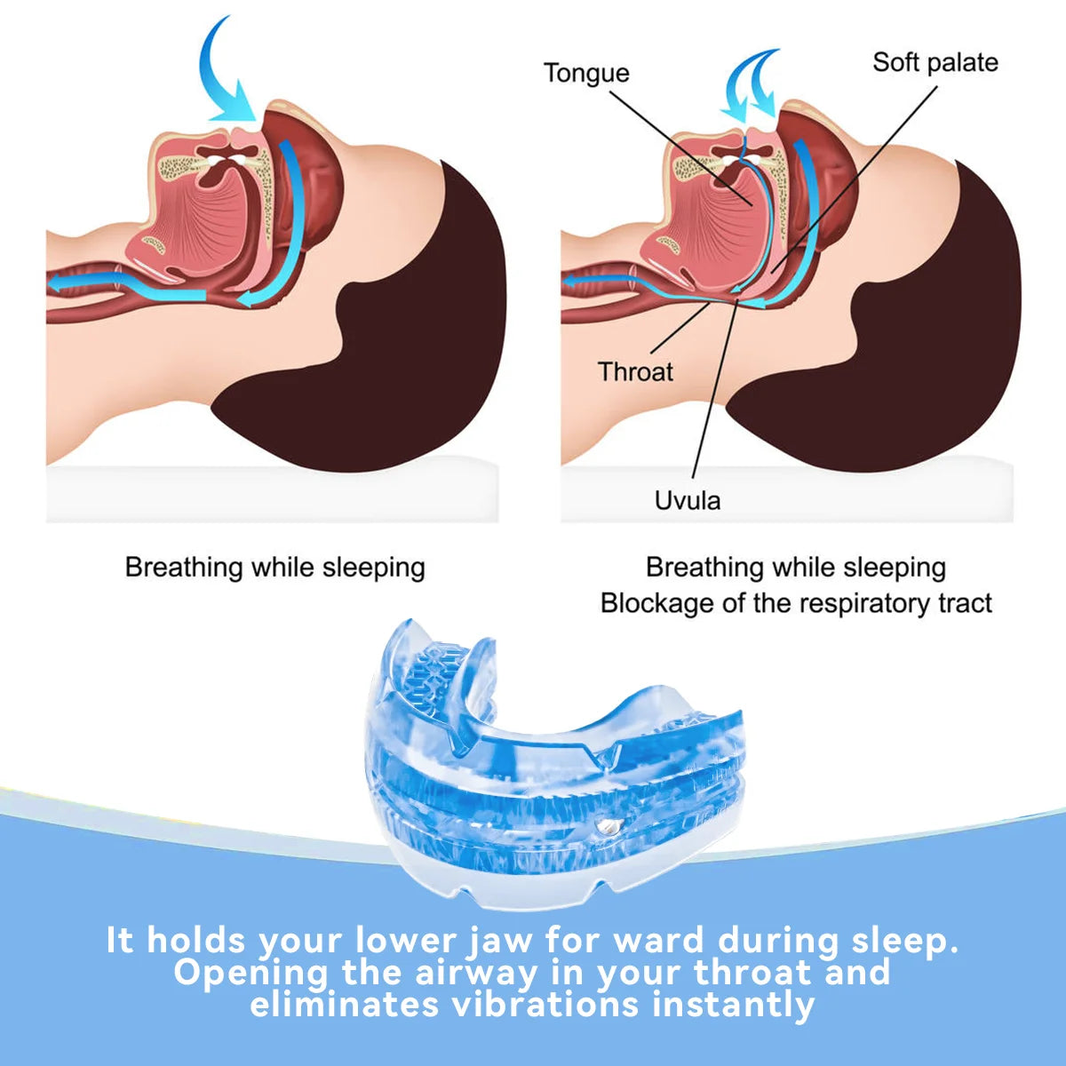 DORMIXA - Night Mouth Guard for Quieter Sleep and Teeth Protection