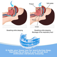 DORMIXA - Night Mouth Guard for Quieter Sleep and Teeth Protection