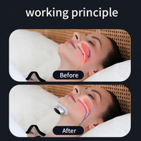 JianYouCare Electric Anti-Snoring Device Dual frequency pulse magnetic attraction quiet Sleep aid Breathing Corrector Stop Snore